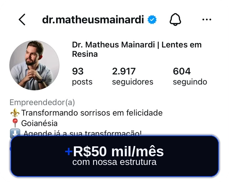Perfil no Instagram de @dr.matheusmainardi, Dr. Matheus Mainardi, especialista em lentes em resina: mais de R$ 50 mil por mês com a estrutura da Wise Odonto.