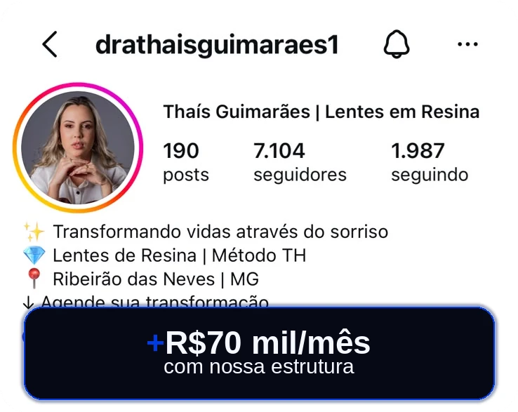 Perfil no Instagram de @drathaisguimaraes1, Thaís Guimarães, especialista em lentes em resina: mais de R$ 70 mil por mês com a estrutura da Wise Odonto.